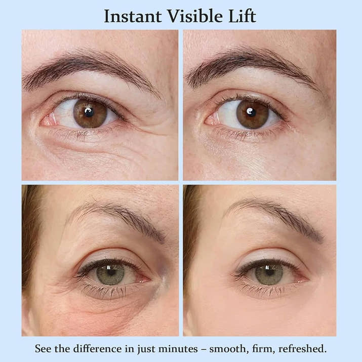Instant Eye Tightening Cream™
