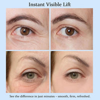 Instant Eye Tightening Cream™